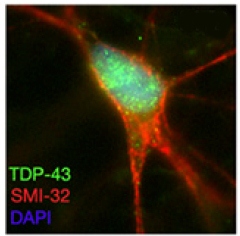 ALS motor neuron iPS TDP-43 not mislocalized