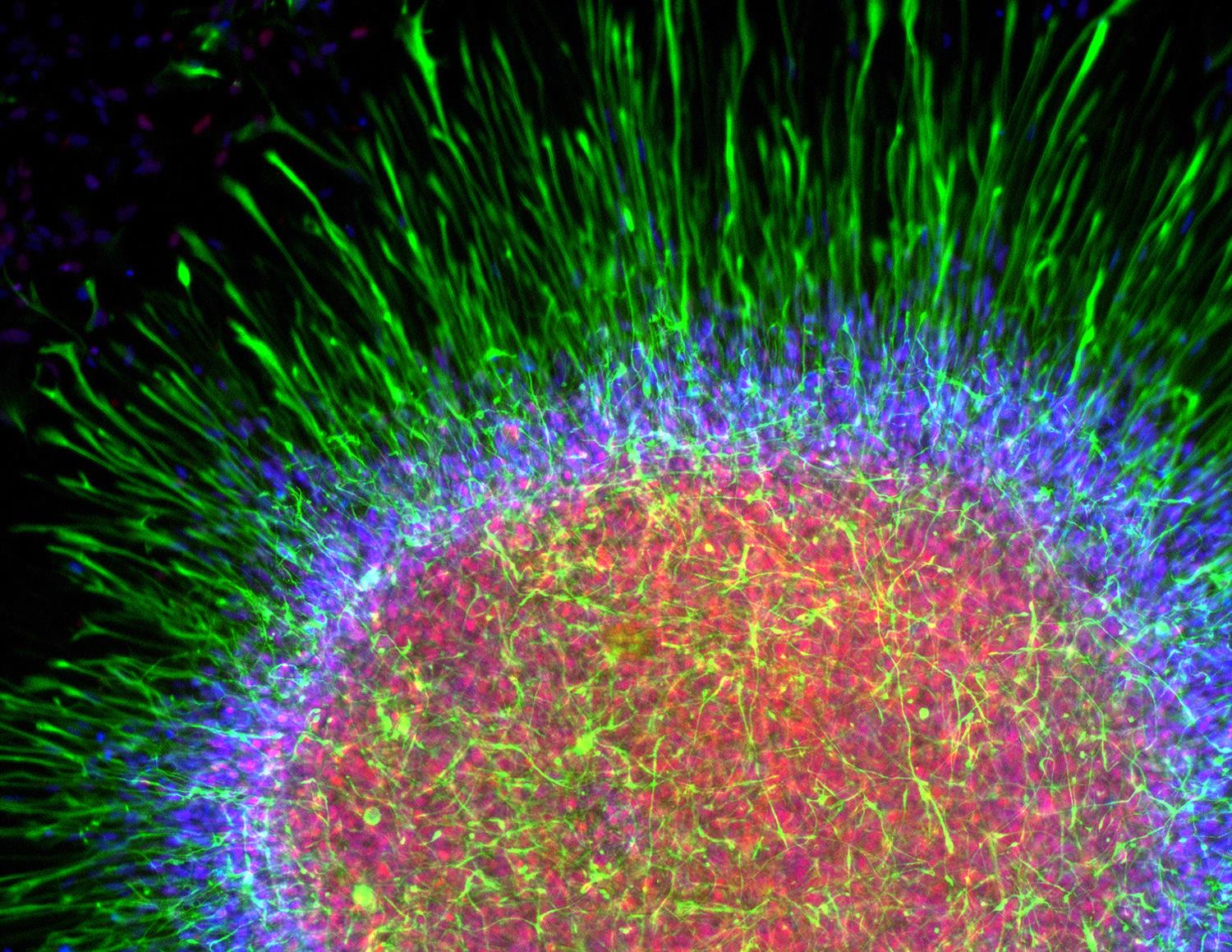 astrocyte als ips stem cell