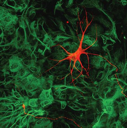 motor neuron astrocyte als mnd